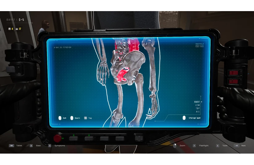 X-ray contraband angle two